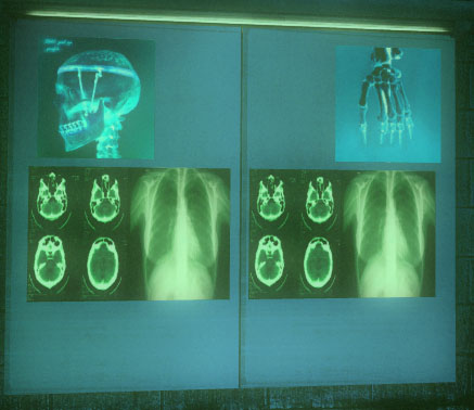 File:Stalker x-ray.jpg